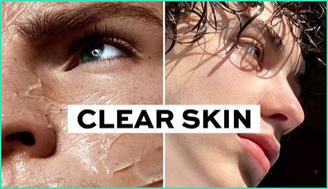 Do models need to have clear skin?